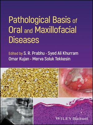 cover image of Pathological Basis of Oral and Maxillofacial Diseases